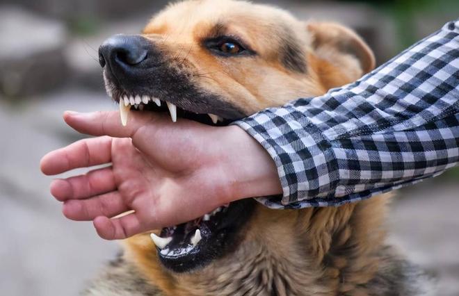 悲剧重演：安徽7岁女童遭恶犬咬伤致毁容，如何避免类似事件？